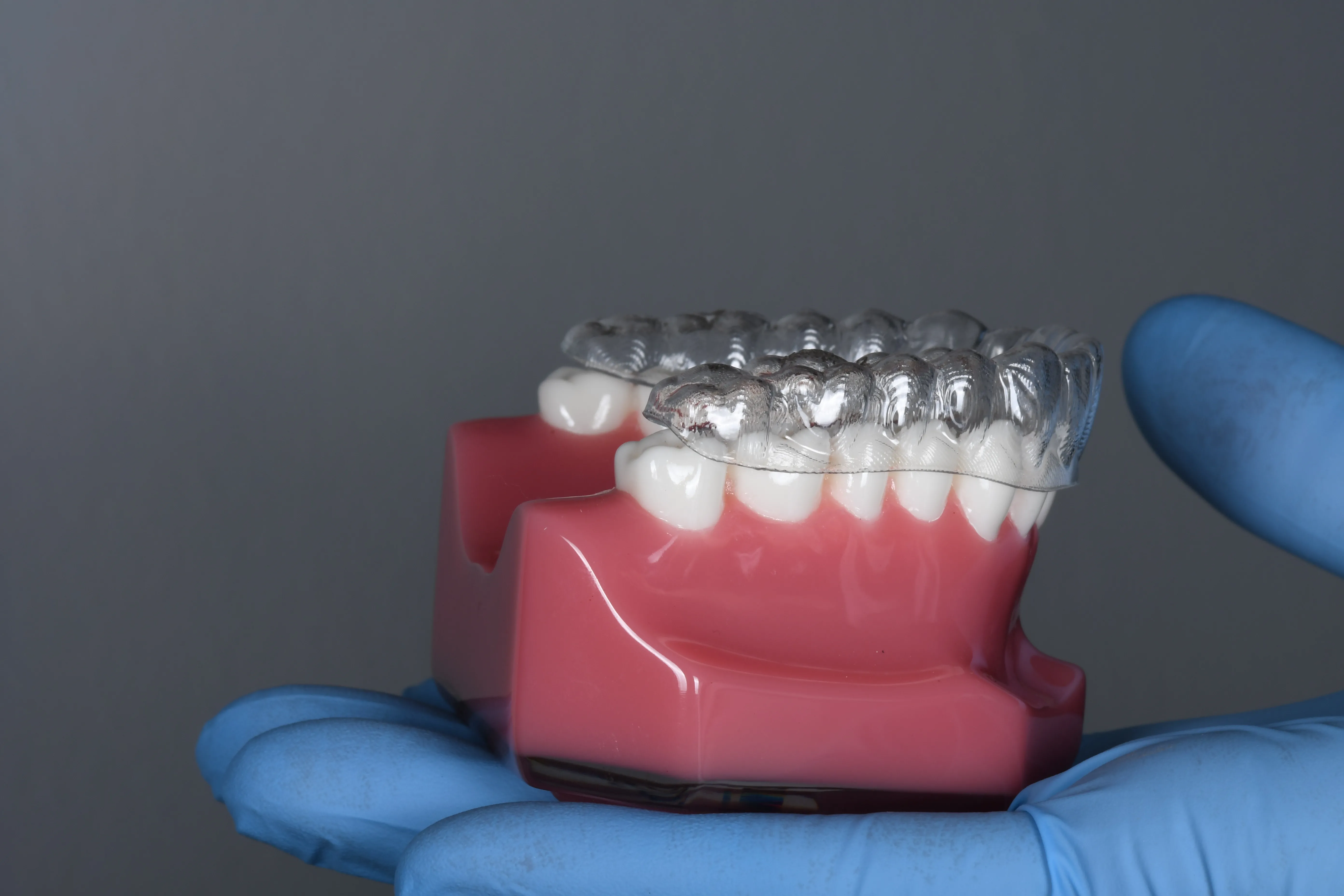 clear-aligners gallery